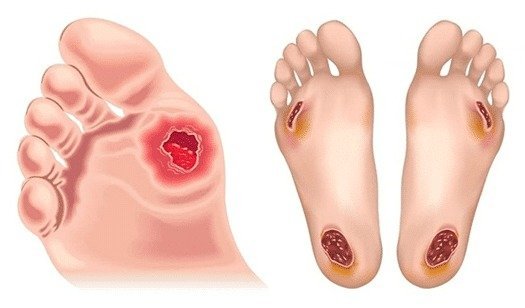 Diabetic foot care at The Foot Doctor